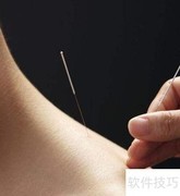 针灸缓解鼻炎新疗法