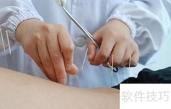 针灸治腰肌劳损及注意事项