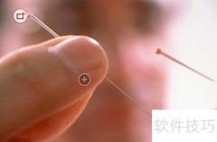 针灸治腰肌劳损及注意事项