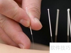 针灸治腰肌劳损及注意事项