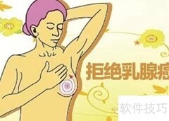 乳腺检查项目全解析