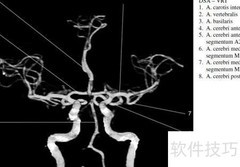 脑CT血管造影正常影像解析