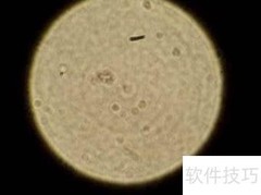 显微镜使用注意事项