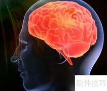 国际智商测试标准解析