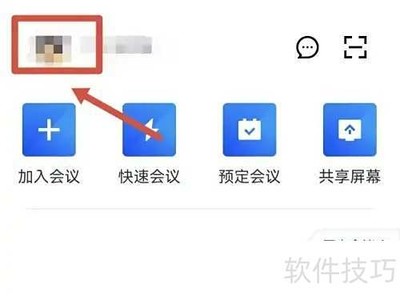 ��Ѷ��Ƶ����ͷ�����÷���