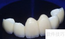 ���Ƴ����޸���ʽһ��