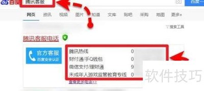 ��Ѷ�ͷ��绰��ͨ��������Щ����