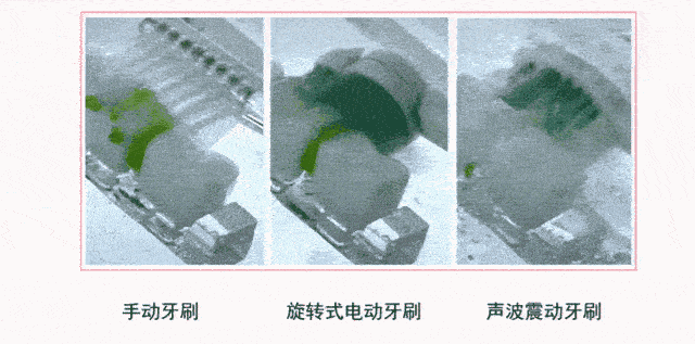 千万别买这种电动牙刷 根本就刷不干净 