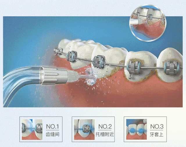 买电动冲牙器是在交智商税？看看这些你就知道了 