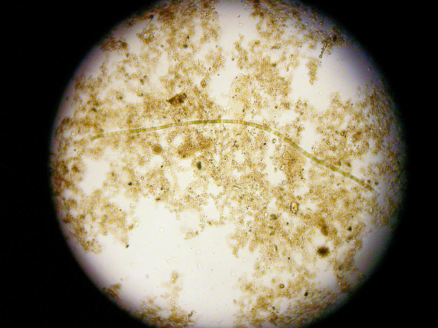 dustie除湿机:阴干的衣服上究竟有多少细菌?