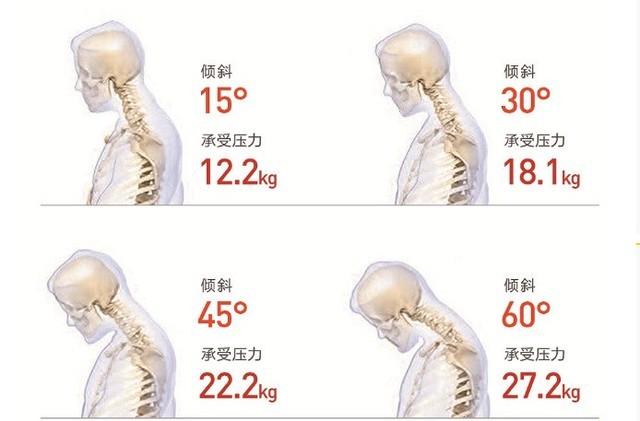 11.11ض֣ҹϷiPhone Xs 