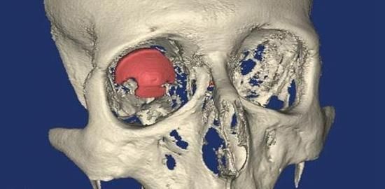 3D��ӡ�¼��� �����׸�3D��ӡ���۵��� 